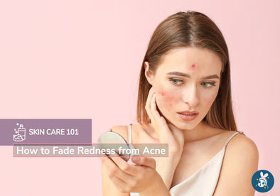 How to Fade Redness from Acne