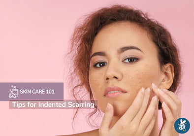 Tips for Indented Scarring