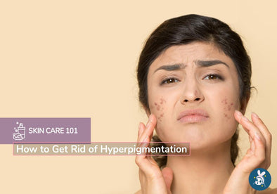 Skincare 101: How to Get Rid of Hyperpigmentation
